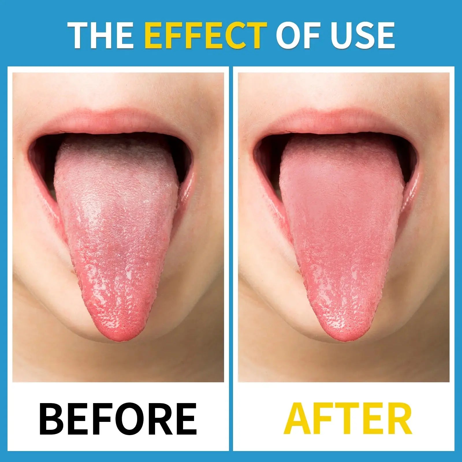 Stainless Steel Tongue Scrapers Pink Iolaus